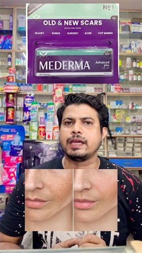 Mederma advanced work or not ✅ @gyanitaksh