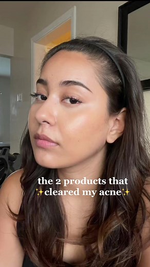 Effective Acne Treatment Products for Clearer Skin