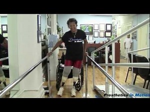 Bi-lateral Below the Knee Amputee Walks in Vacuum Prostheses for the 1st Time!