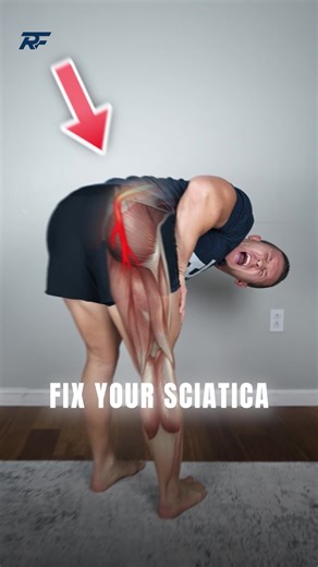 3-Step Sciatica Pain Relief: Nerve Compression Fix