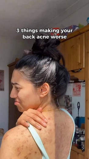 1.3K views | Fix these 3 things. Then add the right treatment. The Bacne Out Bar works with your routine not against it. Natural ingredients that clear back with harsh chemicals that make things worse. What habits do you find help? #backacne #ecloura #bacneoutbar #cleakskin #skincarehabits #bodyacne #chestacne #shoulderacne | Ecloura | Facebook