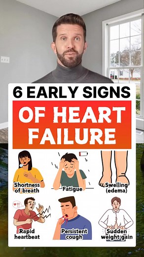 13K views · 61 reactions | 6 early signs of heart failure #healthy #healthcare #healthtips #heart #heartdisease #heartfailure | Dr.Parker | Facebook