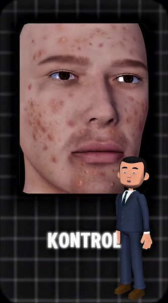 Barber Daily Acne Care untuk Kulit Segar