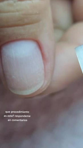 Nail Care Routine: Applying Acrylic Treatment