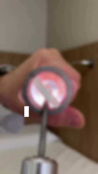 Entenda o Anoscópio: Importância e Funcionamento