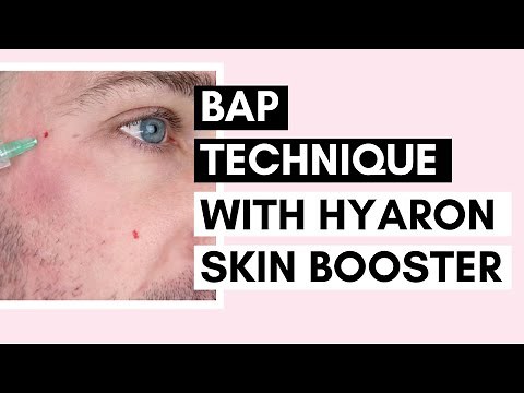 Mesotherapy for Glowing Skin | BAP Technique with Hyaron Skin Booster Ft ‪@Vanidiy‬