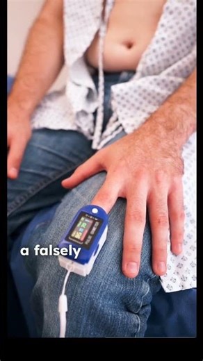 The Carbon Monoxide Trap — Normal PaO₂, but the Patient is Dying. Don’t Miss This!