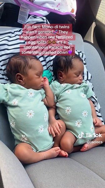 Mono-di Twins: A Rare Miracle Explained