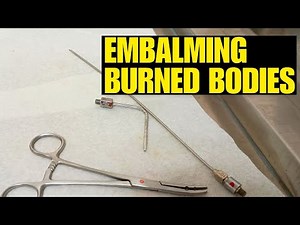 Embalming burned bodies
