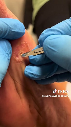 The Foot Doctor on TikTok