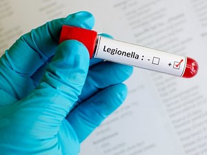 Investigation Into Harlem Legionnaires' Disease Outbreak Closed
