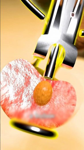 How Cherry Seeds Are Prepared and Grown Into a Fruit Tree 😱