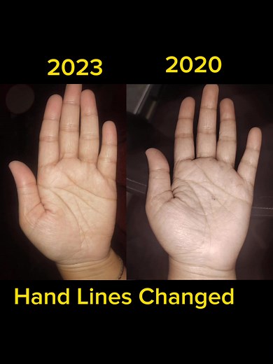 Understanding How Hand Lines Change Over Time