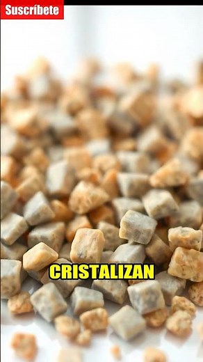 Cálculos Renales: ¡Dolor Intenso! 😱