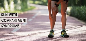 Can You Run With Compartment Syndrome? [What Is It And How To Fix It]