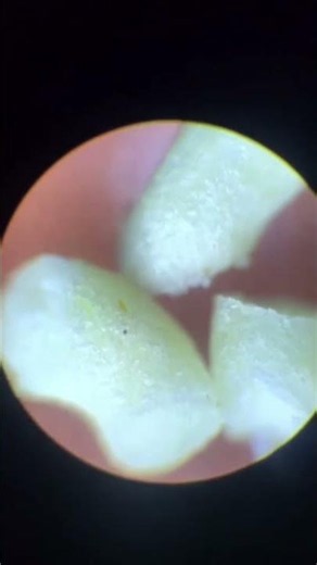 #microscope #magnification
