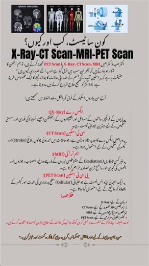 X-Ray, CT Scan, MRI, and PET Scan: What’s the Difference? | Complete Guide