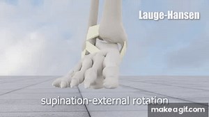 Ankle Fracture Classification on Make a GIF