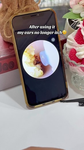 This is a complete set of ear cleaning tools, featuring a wide variety of accessories, and it is very safe and reliable! #earcare #healthtech #crowdfundedtech #earwax #relax #acne #satisfying #earwaxcleaning #asmr #earwaxremoval #TikTokShopLoveAtFirstFind #spotlightfinds #tiktokmademebuyit