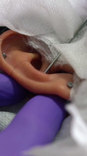 Ear Piercing Procedure: A Close-Up Look