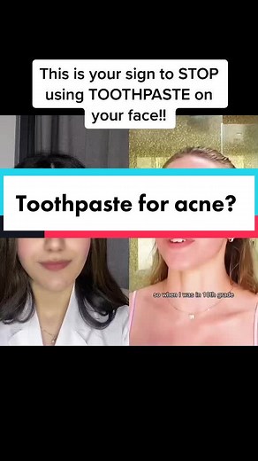 The Truth About Using Toothpaste for Acne