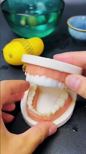 Temporary dental adhesive filling material #teeth #gum #tooth #orthodontics #dentures #filling