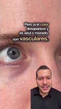 🚨 ¿Sabes por qué tus ojeras no desaparecen? 🚨
