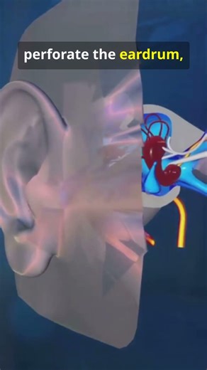 Stop Using Q-Tips: The Real Reason Your Head Hurts#health#facts#headache#earwax#earcleaning#qtips