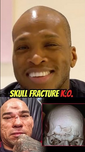 How MVP Broke Cyborg’s SKULL 💀