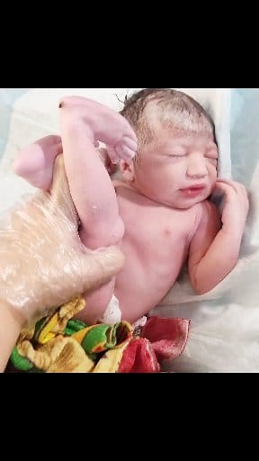Wonderful Moments of Cutest Breech Newborn Baby Immediately After Birth #cutebaby #amazingbabies #cutebabies #firstcry #beautifulbabies #adorablebabies #newborns #babies #babiesvideos #viralbabies | After Birth