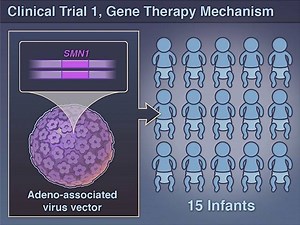 Spinal muscular atrophy is a progressive motor neuron disease with an onset during infancy that results in failure to meet motor milestones and in death or the need for mechanical ventilation by 2 years of age. New research findings are summarized in this short video. Full study: http://nej.md/2il5Jjg Watch more Quick Take videos: http://nej.md/quick-take | The New England Journal of Medicine