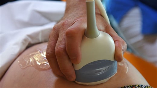 Texas bill would allow child support to begin from conception