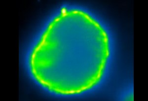 Artificial Cell Membrane Capable of Remodeling is Created | Cell And Molecular Biology