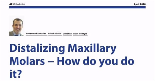 Dr. Mo Almuzian (Orthodontist) on Instagram: "Distalising maxillary molars – quick clinical overview I published a paper on this topic; this is a brief summary with some updates. Many mild–moderate Class II cases are treatable with distalisation when skeletal and vertical patterns are favourable. Indications include dental Class II, mild crowding/impactions and mesial drift after loss of deciduous molars. Compliance-dependent mechanics Headgear and removable plates (ACCO-type) can give 2–4 mm di