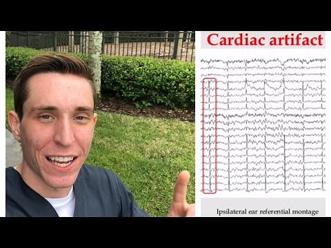 6 EEG Artifacts You Must Know in 6 Minutes