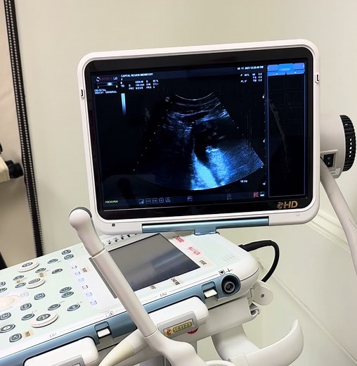 12 week ultrasound, babys upside down. Could immediately tell i was having a boy from this ultrasound🩵💙