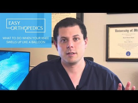 What to do when your knee swells up like a balloon