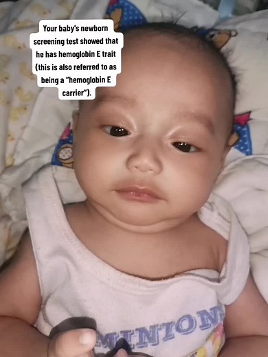 Understanding Newborn Screening for Hemoglobin E Trait Carrier