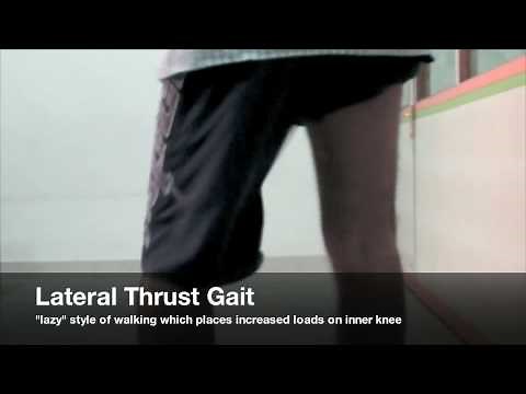Improper gait causing excessive loading on knee
