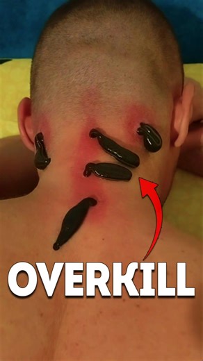 32 Brains, 10 Eyes, 300 Teeth: The ultimate hunter. #leeches #worms #shorts