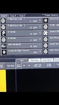 How to Preset or Edit CT Protocols in Toshiba modality #toshiba #ct