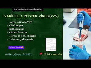 Varicella Zoster Virus (VZV) | Chickenpox & Shingles: Pathogenesis, Clinical Features & Diagnosis