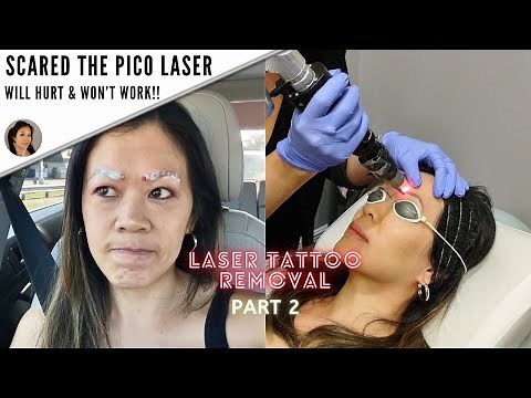 How I got my microblading removed (Before & After)-Part 2
