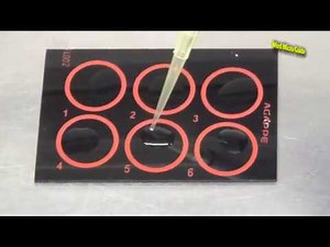 Rheumatoid Factor test