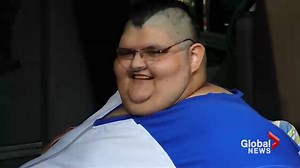 World’s reportedly heaviest man set to undergo surgery