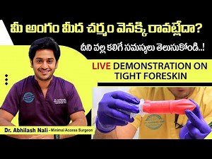 Live Demonstration on Tight Foreskin || Phimosis and Balanitis || Circumcision || Dr Abhilash Nali