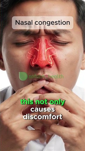 Nasal congestion #safahhhealth #sinusitis #irigasinasal