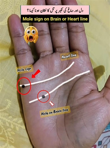 Meaning of mole sign on Heart line and brain line in palmistry #palmistry #foryoupage❤️❤️ #mole #palmreading #astrology