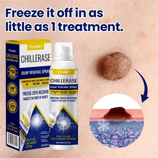 Rough bumps or uneven skin? ❄ Timilk® ChillErase Spray cools, smooths & renews skin safely. ✅ Visible results in 7-14 days ✅ Soothes redness instantly · Safe for all skin types Cool. Calm. Renew. Your best skin starts here ❄ https://opulentderm.com/products/chillerase-bump-renewal-spray | Kayleigh Elwell Eric