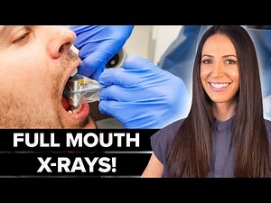 Dental Hygienist Explains Full Mouth Dental X-Ray (FMX)